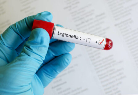 Legionnaires' Outbreak